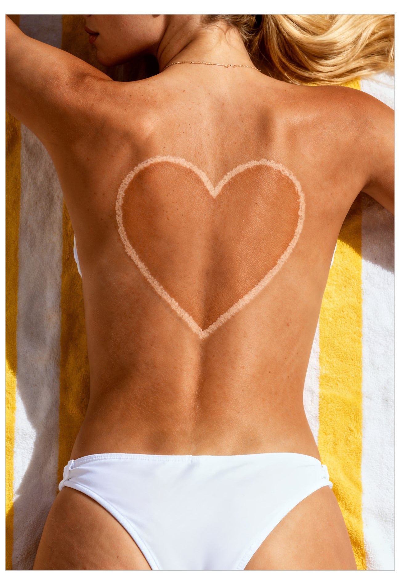 Woman with a heart-shaped sunburn on her back, wearing a white bikini.
